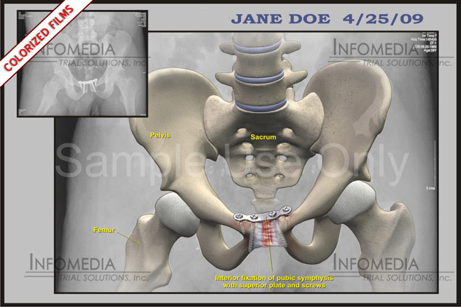 Medical Illustrations