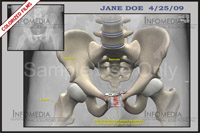 Medical Illustrations